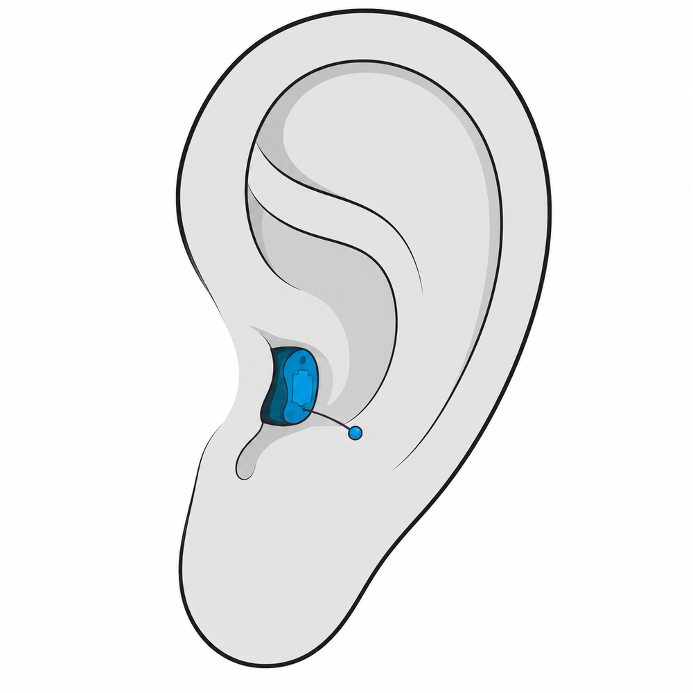 Completely-in-Canal (CIC) hearing aid style