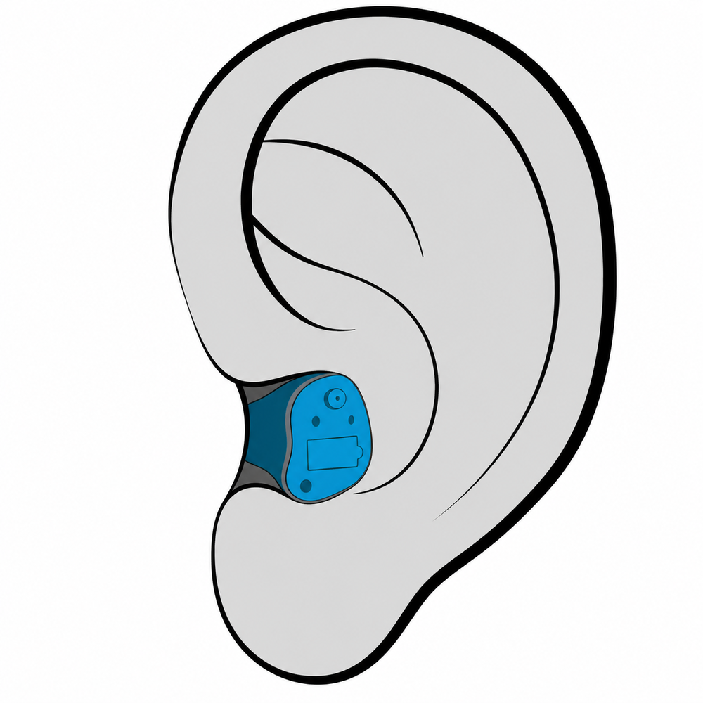 In-the-Canal (ITC) hearing aid style