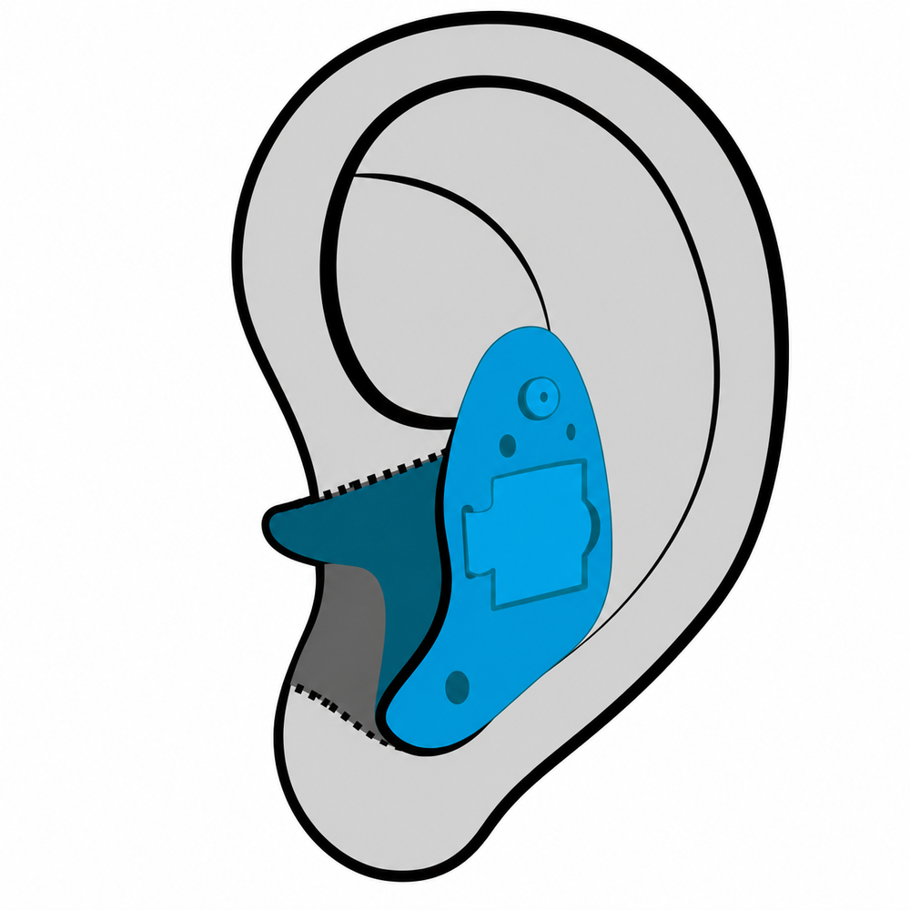 In-the-Ear (ITE) hearing aid style